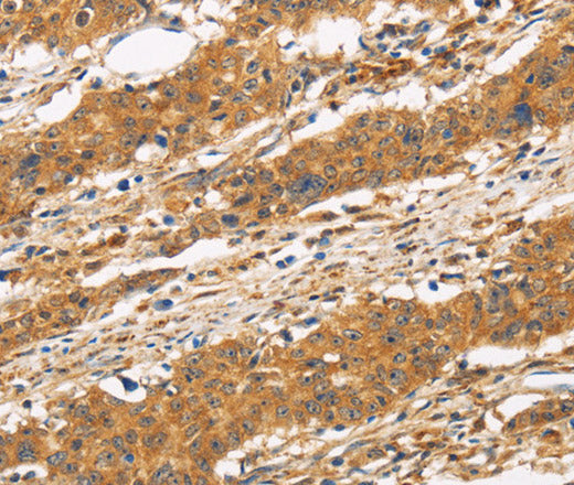 CD22 Polyclonal Antibody – Figure 1 of 3