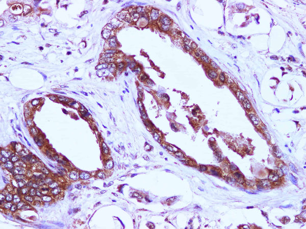 EIF4EBP1 Polyclonal Antibody – Figure 1 of 2