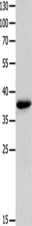MYOZ1 Polyclonal Antibody – Figure 1 of 3