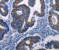 MKP-3 Polyclonal Antibody – Figure 1 of 2
