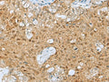 PTPA Polyclonal Antibody – Figure 1 of 3