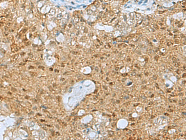 PTPA Polyclonal Antibody – Figure 1 of 3