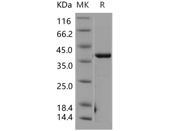 Recombinant Human CSNK2A2/CK2A2 Protein – Figure 1 of 2