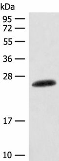 CSNK2B Polyclonal Antibody – Figure 1 of 4