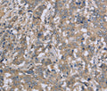 DTNB Polyclonal Antibody – Figure 1 of 3