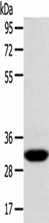 CCS Polyclonal Antibody – Figure 1 of 3