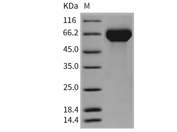 Recombinant Mouse Hemopexin/HPX Protein (His Tag) – Figure 1 of 2