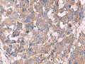 KCNN3 Polyclonal Antibody – Figure 1 of 3