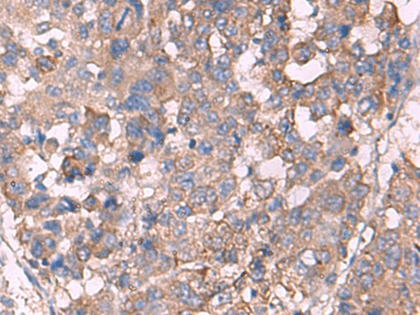 KCNN3 Polyclonal Antibody – Figure 1 of 3