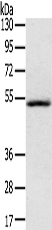 IL17RB Polyclonal Antibody – Figure 1 of 4