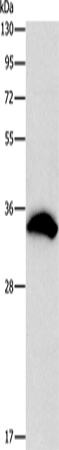 CDCA8 Polyclonal Antibody – Figure 1 of 4