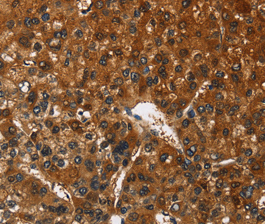 CATSPER4 Polyclonal Antibody – Figure 1 of 3
