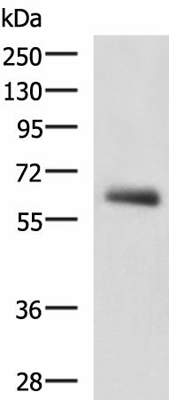 KBTBD11 Polyclonal Antibody – Figure 1 of 2