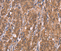 FBXO31 Polyclonal Antibody – Figure 1 of 3