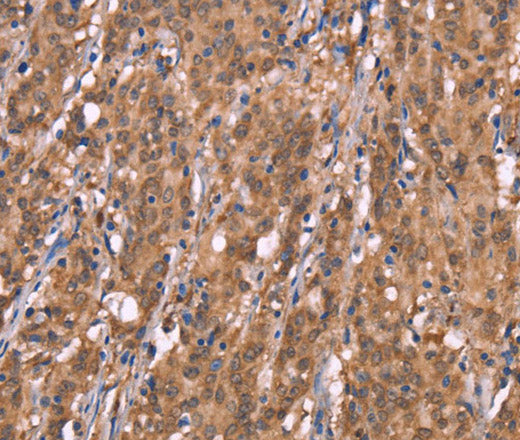 FBXO31 Polyclonal Antibody – Figure 1 of 3
