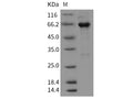 Recombinant Mouse EphA3 Protein (aa 569-984, His & GST Tag) – Figure 1 of 2