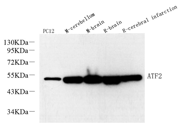 ATF2 Polyclonal Antibody – Figure 1 of 2