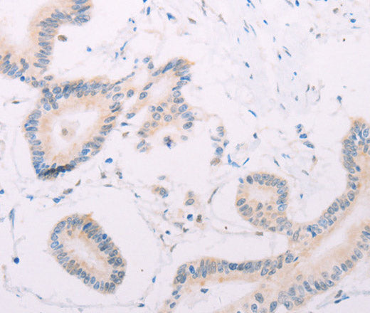 MAP3K12 Polyclonal Antibody – Figure 1 of 3
