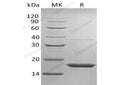 Recombinant Human Transthyretin/TTR Protein (His Tag) – Figure 1 of 2