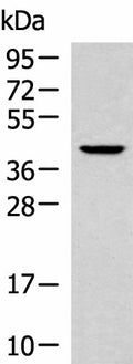 KLF6 Polyclonal Antibody – Figure 1 of 2
