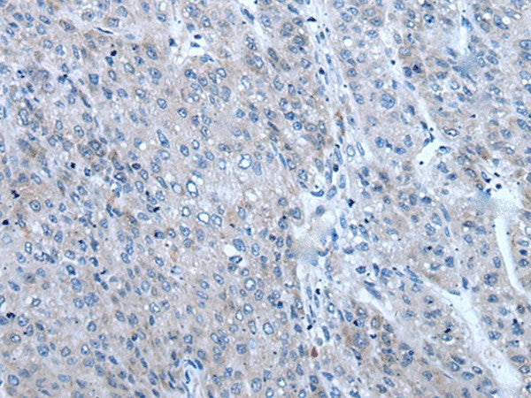ZIC1 Polyclonal Antibody – Figure 1 of 3