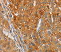 ARSG Polyclonal Antibody – Figure 1 of 3