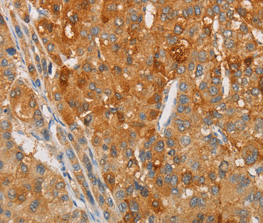 ARSG Polyclonal Antibody – Figure 1 of 3