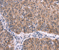 Ephrin A5 Polyclonal Antibody – Figure 1 of 3