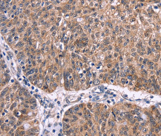 Ephrin A5 Polyclonal Antibody – Figure 1 of 3