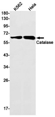 Recombinant Catalase Monoclonal Antibody – Figure 1 of 3