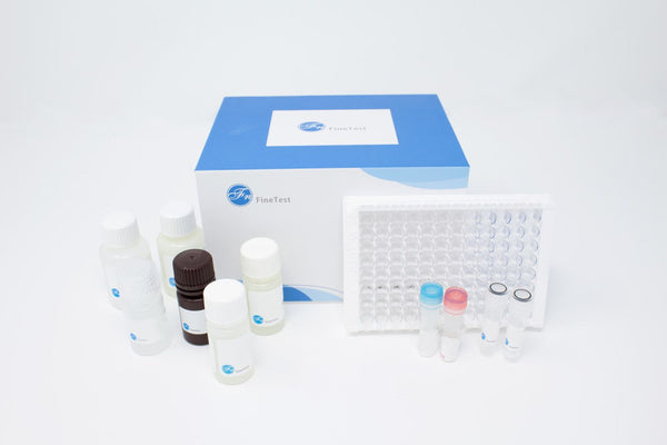 Rat ULK1 (Serine/threonine-protein kinase) ELISA Kit