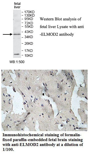 Anti-ELMOD2 Antibody – Figure 1 of 1