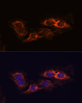 RIP3 Polyclonal Antibody – Figure 1 of 6