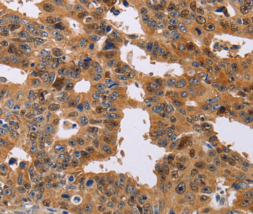 NIF3L1 Polyclonal Antibody – Figure 1 of 3