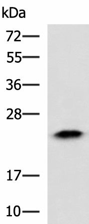 ABHD14B Polyclonal Antibody – Figure 1 of 4