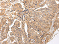 CLDND2 Polyclonal Antibody – Figure 1 of 2