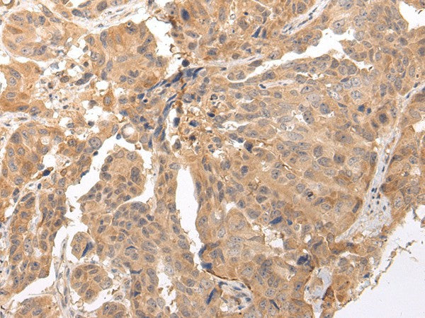 CLDND2 Polyclonal Antibody – Figure 1 of 2