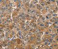 TRIP4 Polyclonal Antibody – Figure 1 of 3