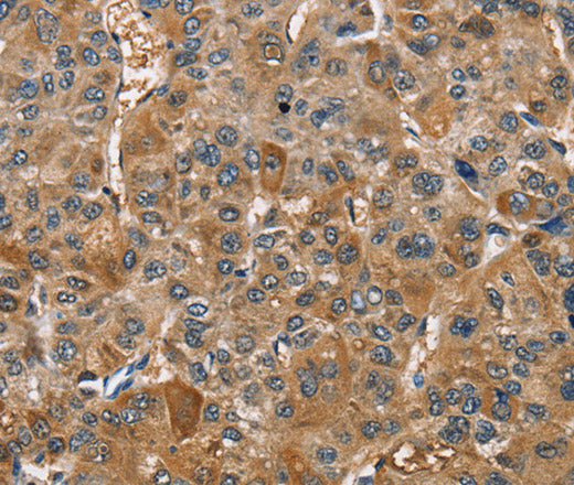 TRIP4 Polyclonal Antibody – Figure 1 of 3