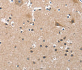 BUB1 Polyclonal Antibody – Figure 1 of 3
