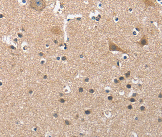 BUB1 Polyclonal Antibody – Figure 1 of 3