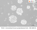 Immortalized Human Lymphoblastoid Cells – EBV (KMS-9) – Figure 1 of 1