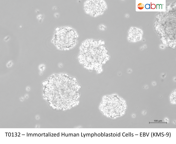Immortalized Human Lymphoblastoid Cells – EBV (KMS-9) – Figure 1 of 1