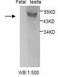 Anti-ESR2 Antibody – Figure 1 of 1