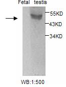 Anti-ESR2 Antibody – Figure 1 of 1