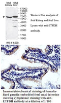 Anti-ETFDH Antibody – Figure 1 of 1