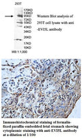 Anti-EVI5L Antibody – Figure 1 of 1