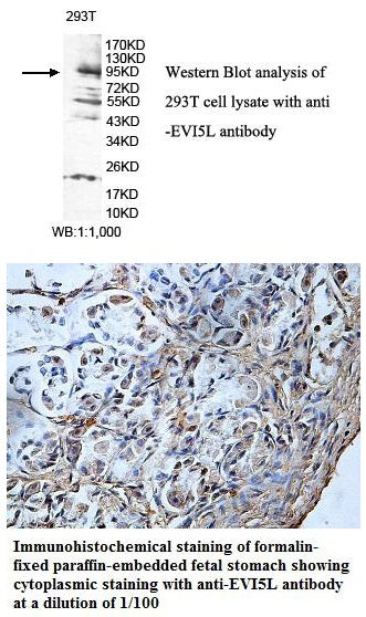 Anti-EVI5L Antibody – Figure 1 of 1