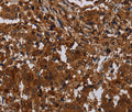 MAGEB18 Polyclonal Antibody – Figure 1 of 3