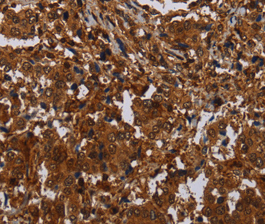 MAGEB18 Polyclonal Antibody – Figure 1 of 3